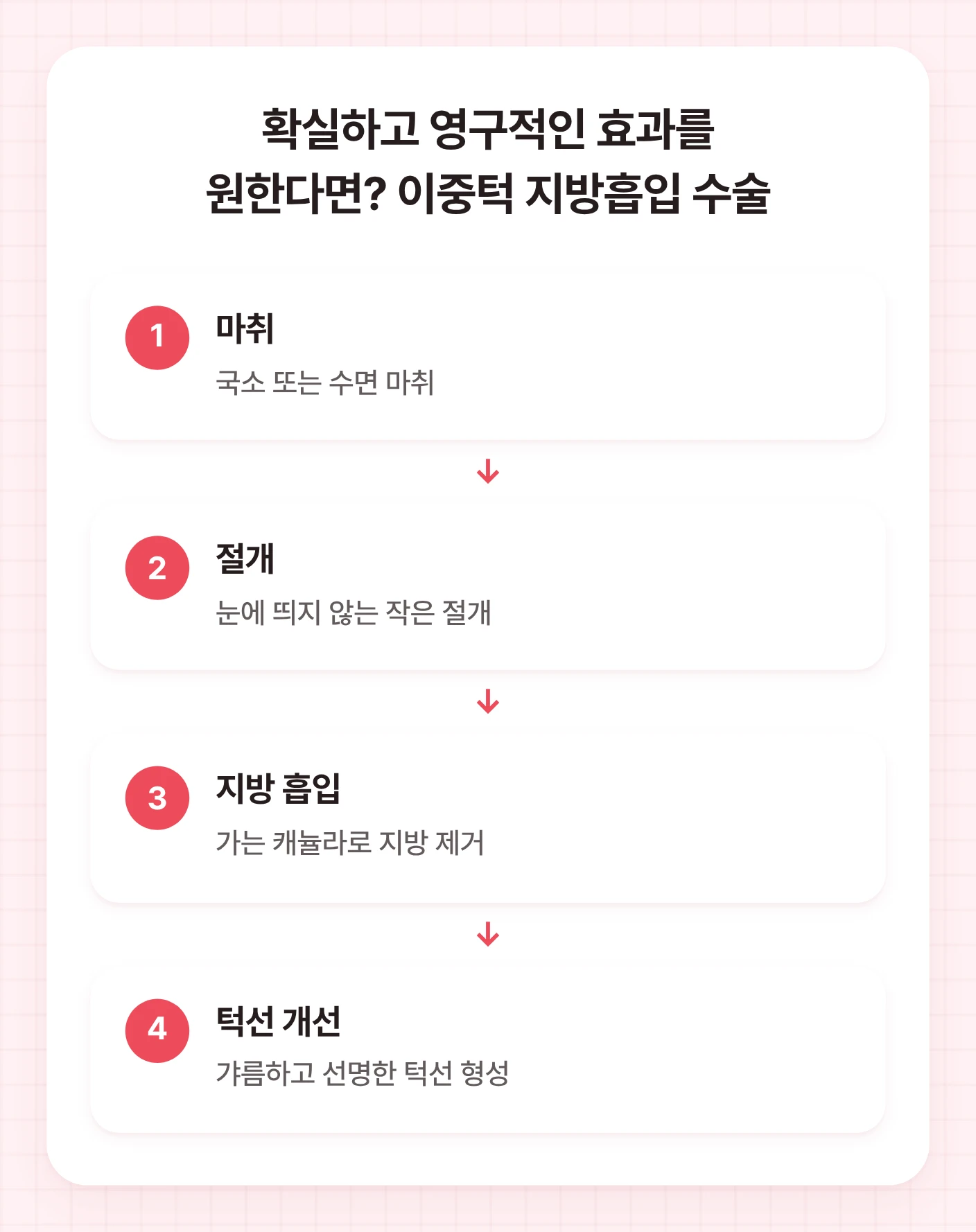 이중턱 지방흡입 수술 과정을 보여주는 플로우차트. 마취, 절개, 지방 흡입, 턱선 개선의 4단계로 구성되어 이중턱지방제거 수술 과정을 설명합니다.